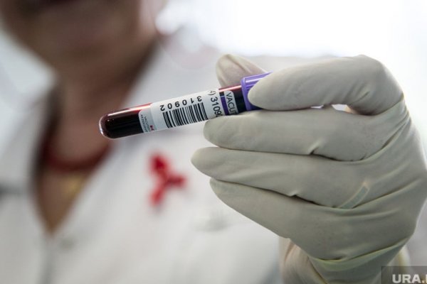 Реальный срок может получить жительница Коми за то, что скрыла от партнеров свой диагноз ВИЧ