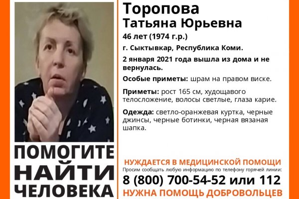 В Сыктывкаре ищут 46-летнюю женщину со шрамом на правом виске