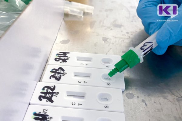В Коми выявлено 33 новых случая коронавируса