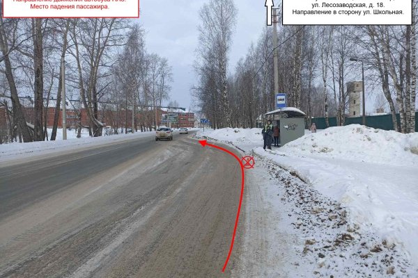 В Сыктывкаре водитель автобуса зажал дверью голову ребенку