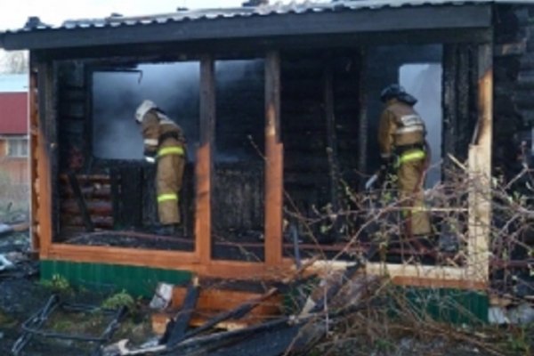 В Усть-Цилемскую больницу с ожогами доставили целую семью