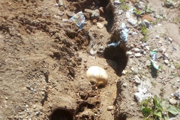 В Сыктывдинском районе на дороге ливень обнажил человеческие черепа