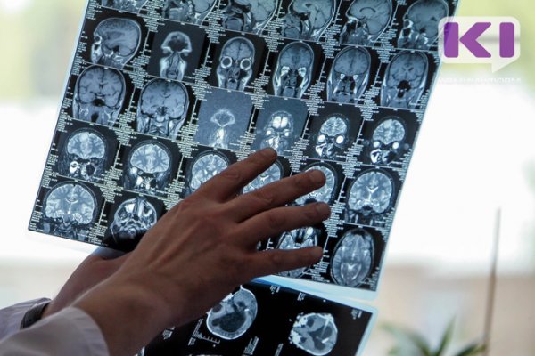Эксперты назвали средний возраст диагностики рака в России