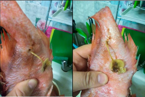Сыктывкарец бонусом к рыбе приобрел 7-сантиметрового паразита 