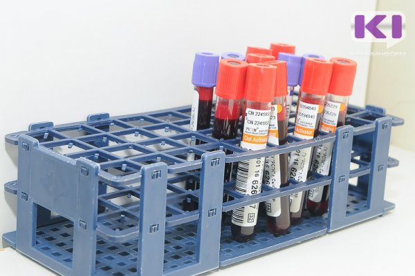 Главный гематолог Коми рекомендует сдавать общий анализ крови хотя бы раз в год

