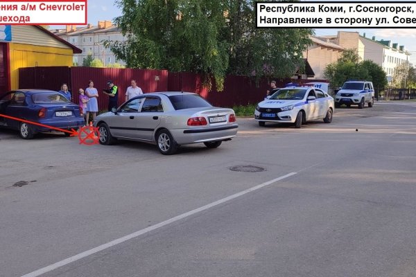 В Сосногорске водитель задним ходом сбил женщину