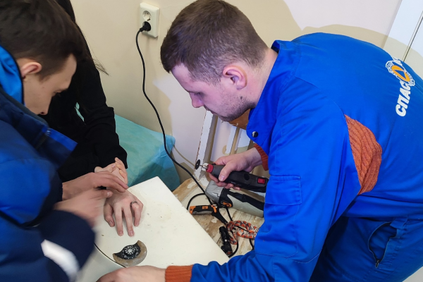 Непростое украшение: в Ухте девочке понадобилась помощь спасателей, чтобы снять кольцо