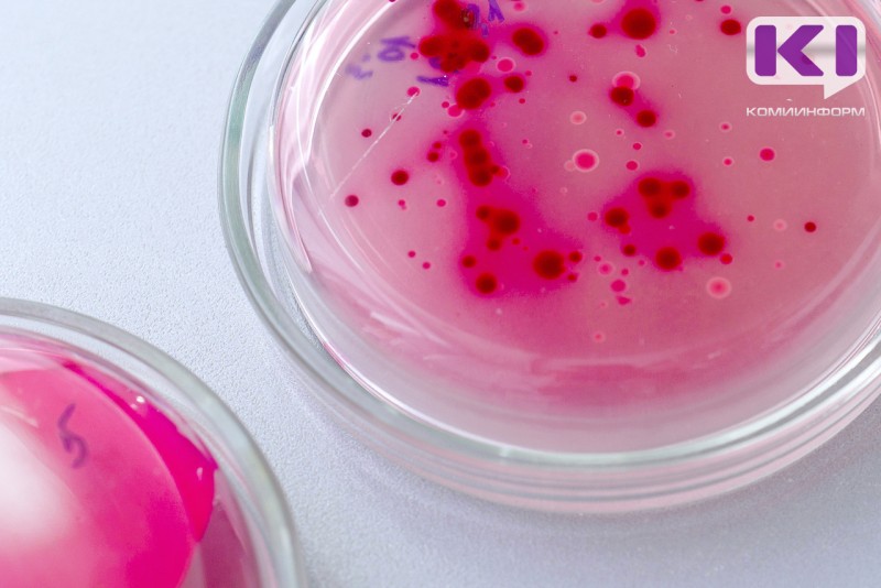 В Коми стали меньше болеть энтеровирусом, туберкулезом и педикулезом