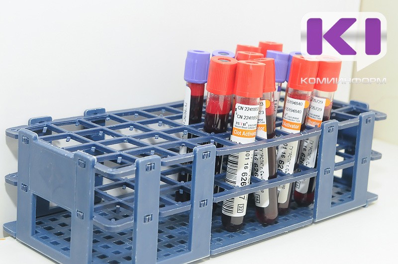 В Коми в январе-феврале резко выросла заболеваемость ВИЧ-инфекцией 