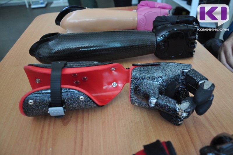 Прокуратура Сыктывкара в суде защитила право женщины-инвалида на получение экзопротеза

