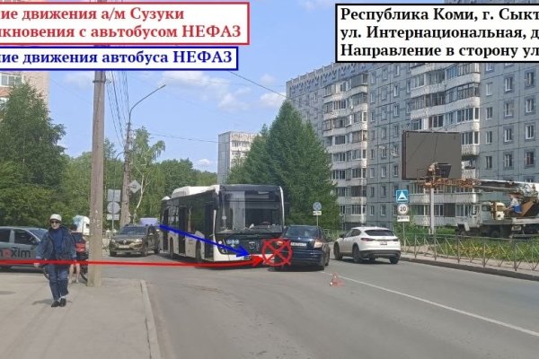 В Сыктывкаре при столкновении Suzuki и автобуса пострадал ребенок 