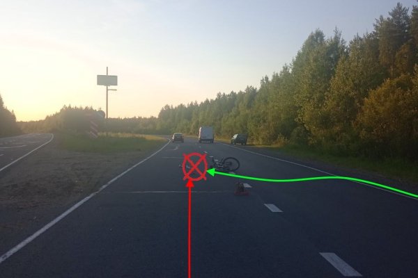 В Сыктывкаре пожилой велосипедист оказался в больнице после наезда иномарки

