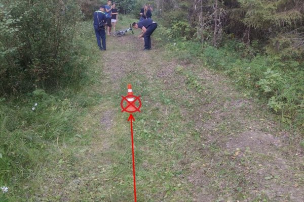 В Сысольском районе девочка опрокинулась на питбайке