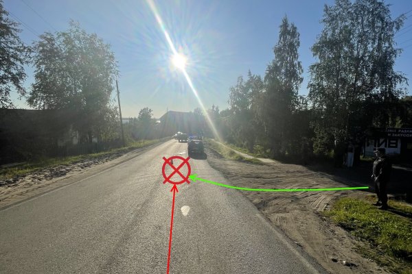 В Усть-Цилемском районе водитель ВАЗа отправил в больницу велосипедиста