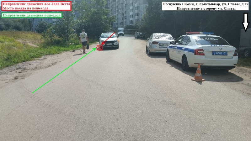 В Эжве пострадал ребенок на самокате 