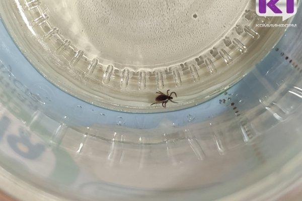 В Коми от укусов клещей за неделю пострадали более 20 человек 