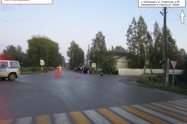 Стали известны подробности ДТП в Койгородском районе, в котором пострадали подростки на электросамокате