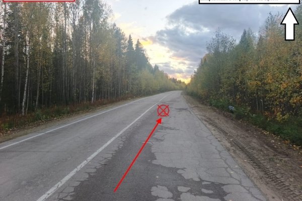 В Усть-Куломском районе во время движения загорелся мопед, водитель получил ожоги и травмы