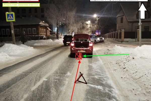 В Сыктывкаре водитель Renault сбил девочку на пешеходном переходе 