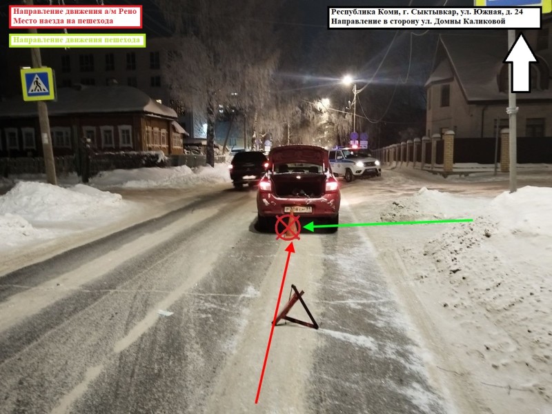 В Сыктывкаре водитель Renault сбил девочку на пешеходном переходе 